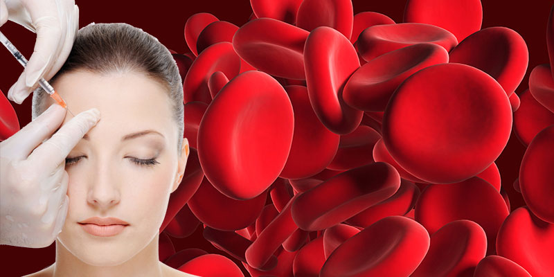 Neveiksmīgas matu transplantācijas labošana: korekcijas iespējas